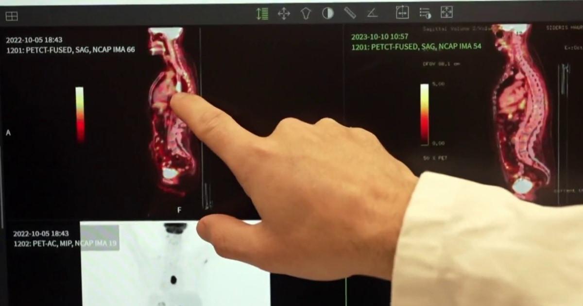 Bước đột phá lớn trong điều trị ung thư