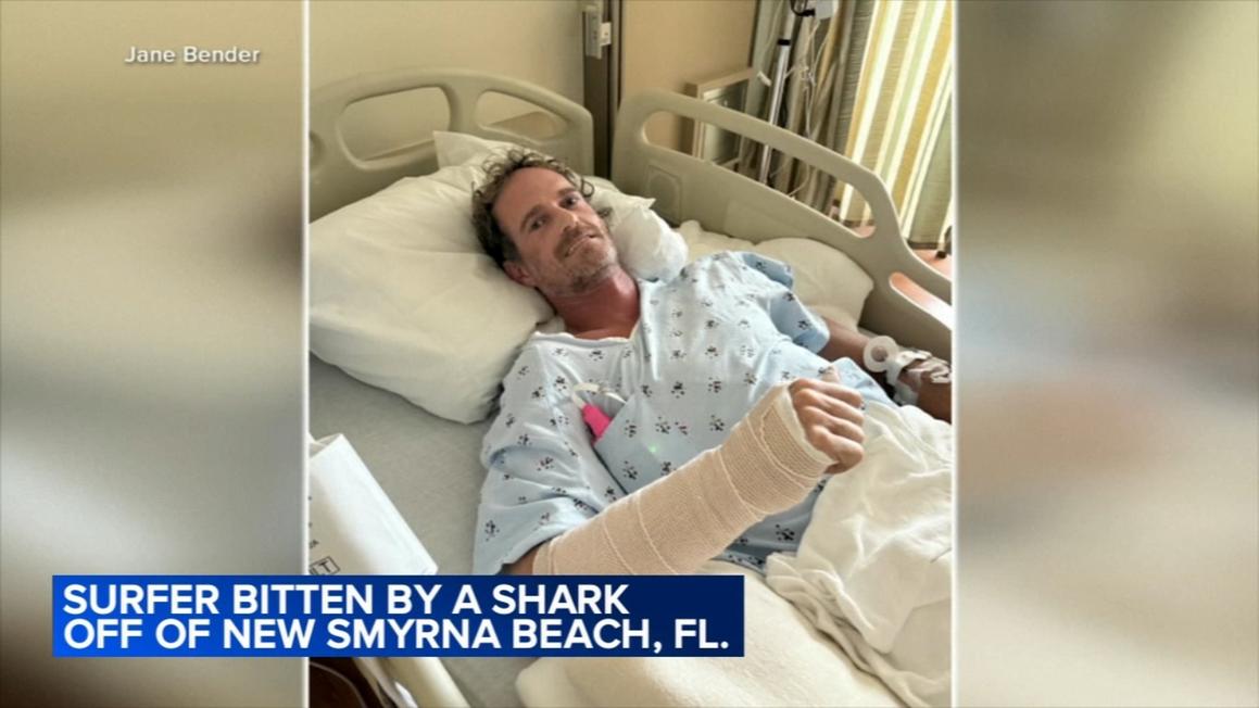 Florida: Người lướt sóng nhập viện vì bị cá mập cắn