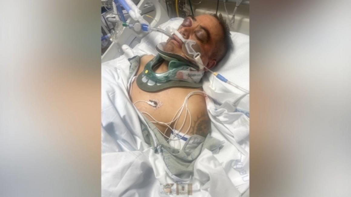 17071640 071125 wls kabc ventura co immigration raid injury clean img