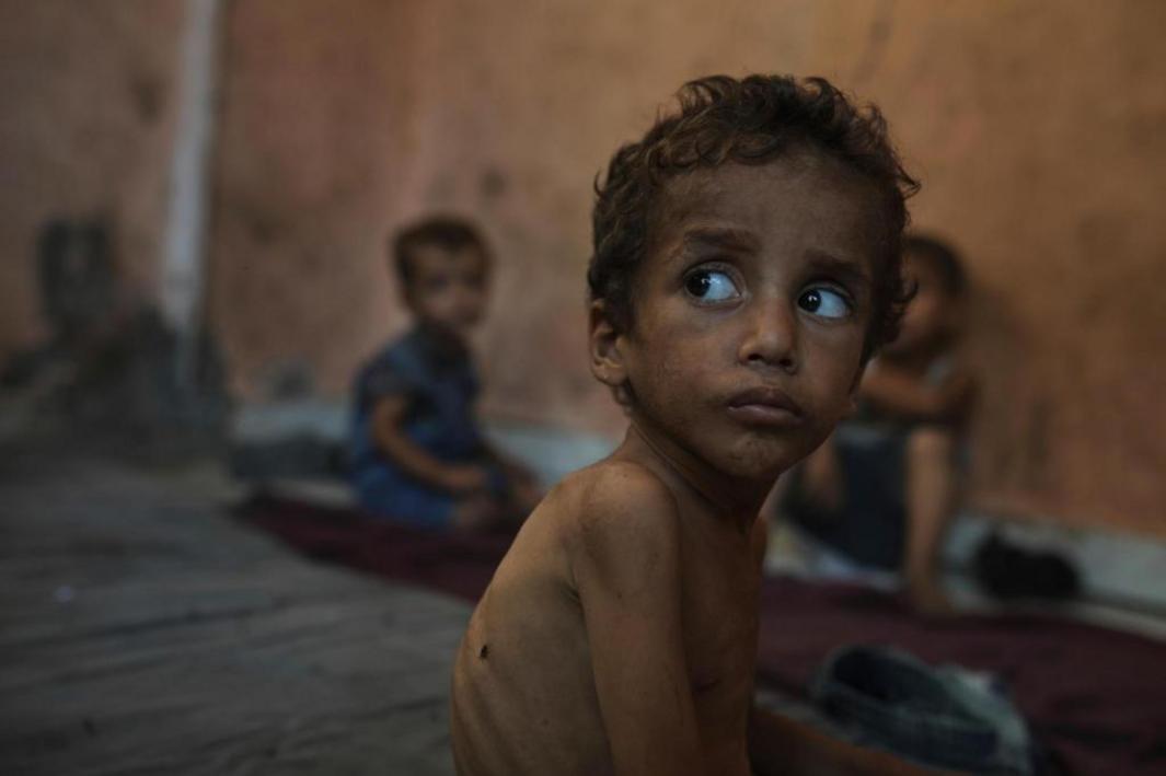 Mideast Wars Dying of Hunger 50809 db447c 1