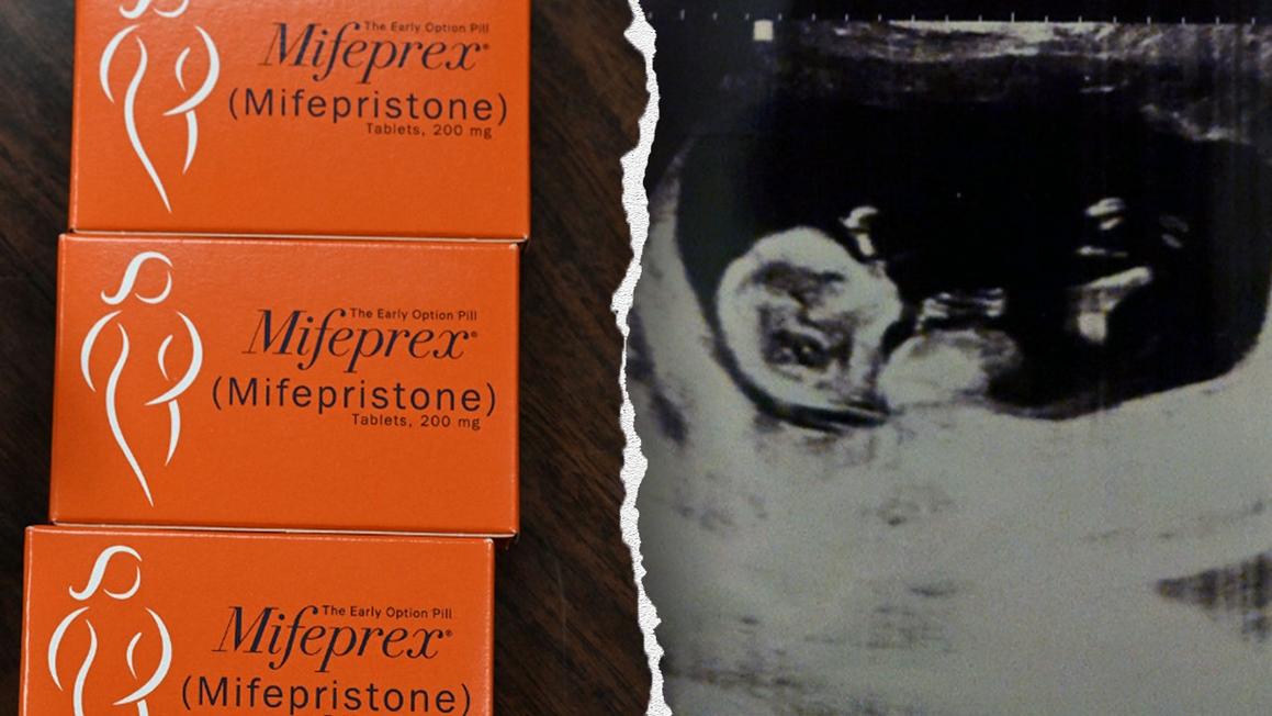 texas father sues california abortionist